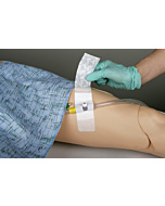Foley Catheter Adhesive Securement Device